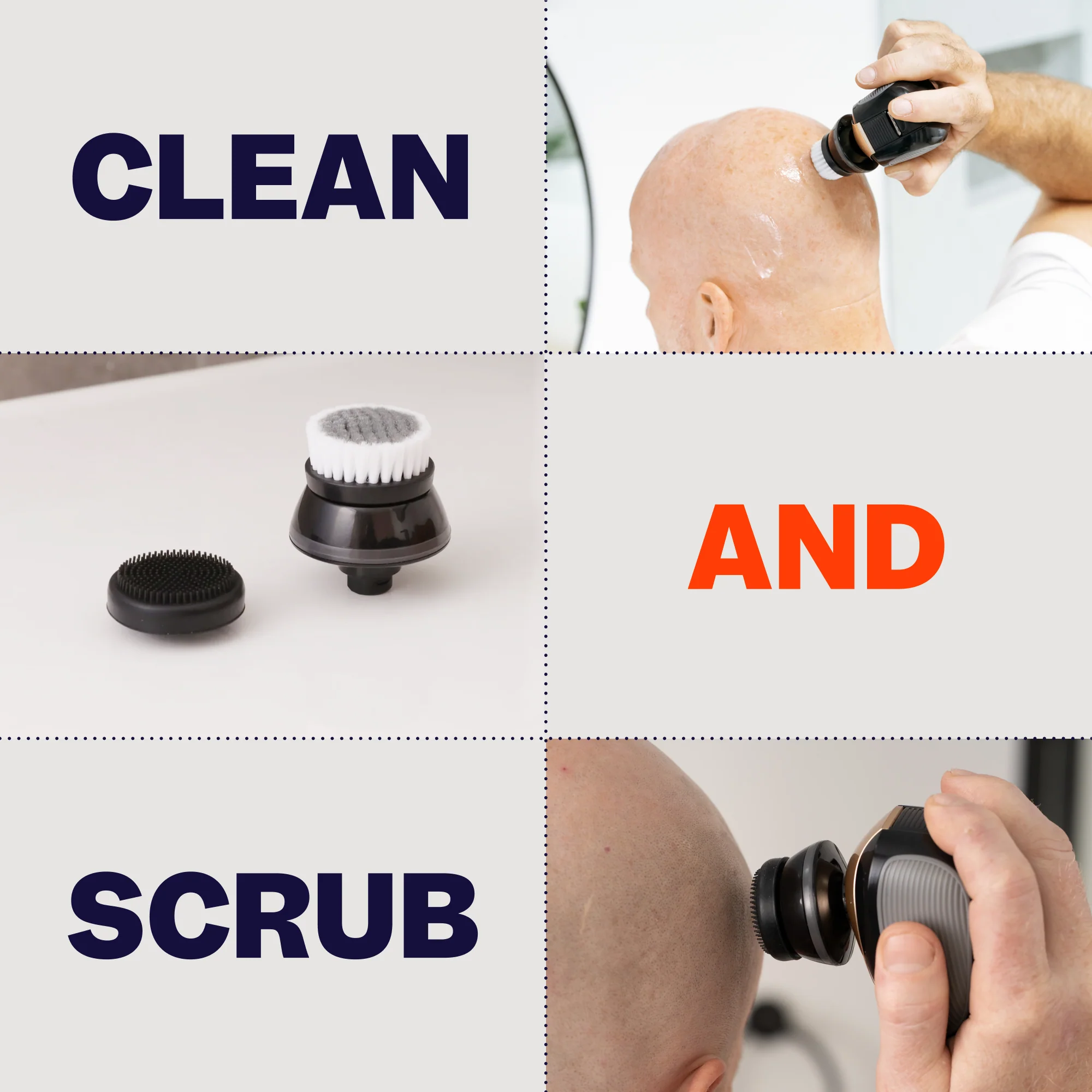 FlexSeries® Attachment Kit - Image 7