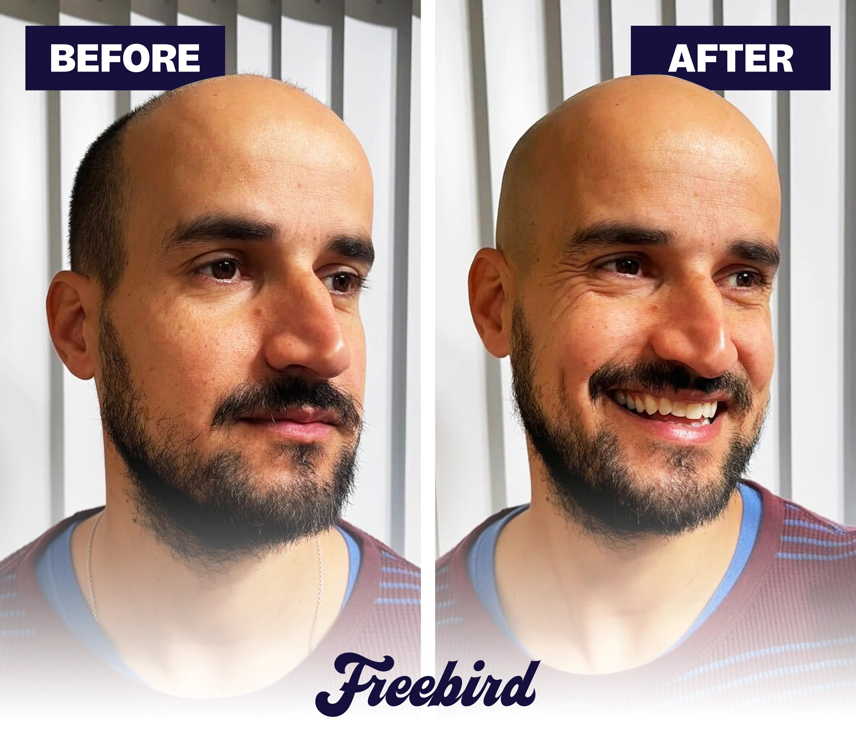 FlexSeries® Shaving Kit - Image 3