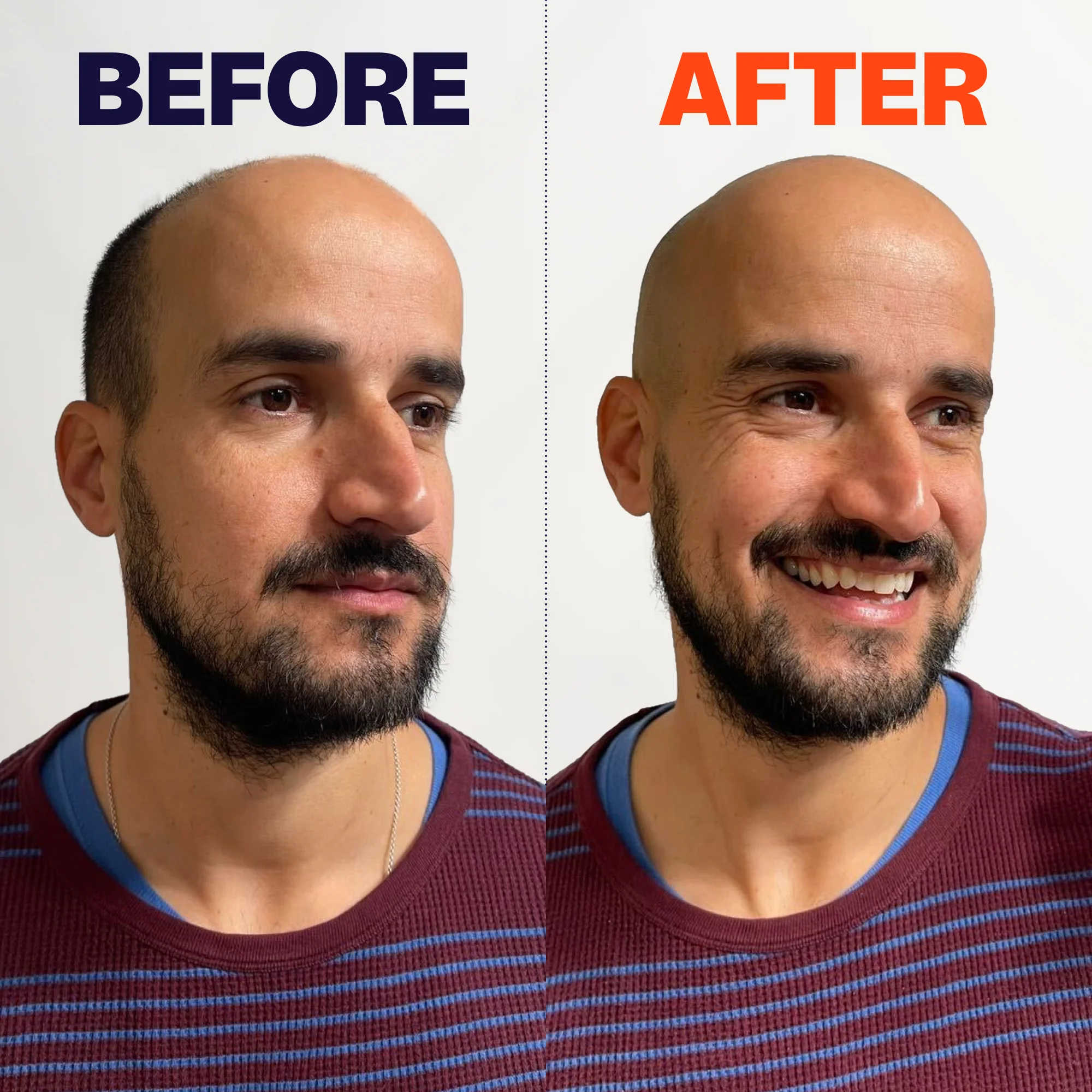 FlexSeries® Shaving Kit - Image 3